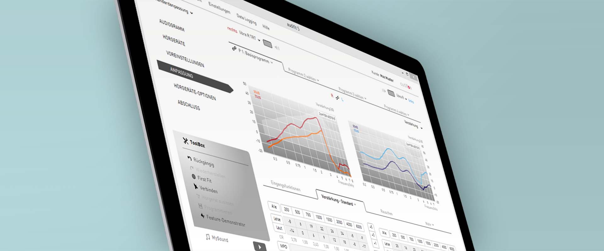 audfon: fitting software audifit